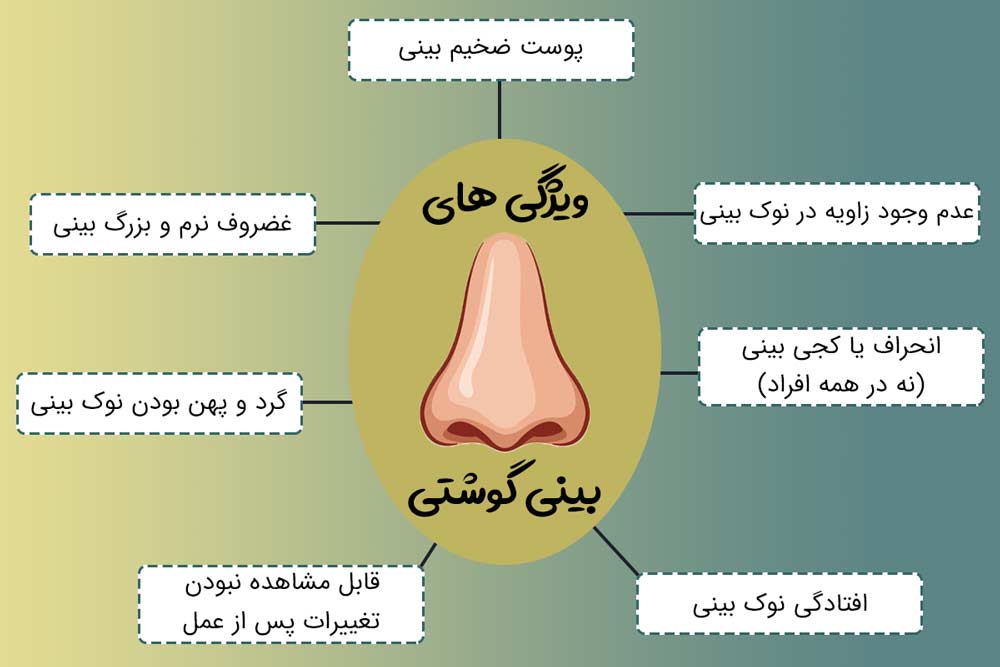 خصوصیات بینی گوشتی