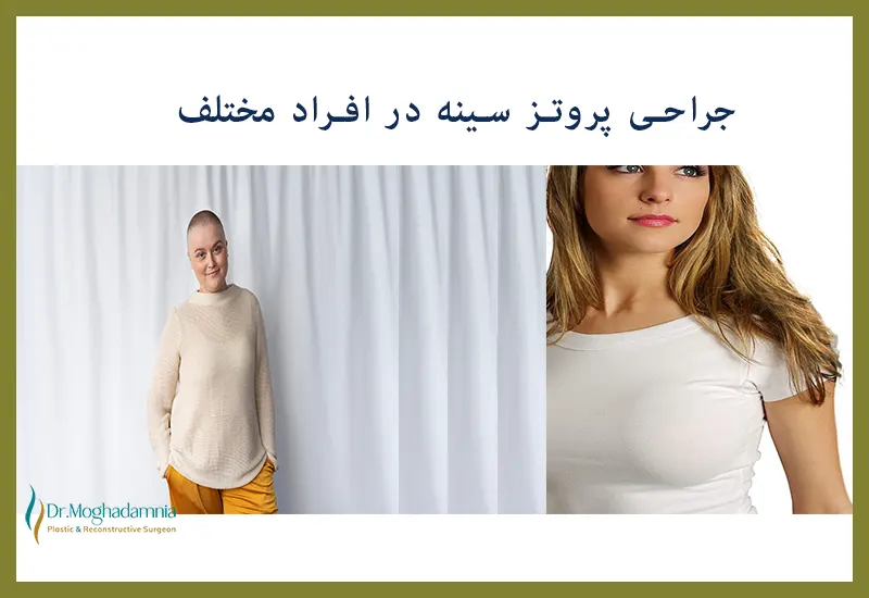 افراد مختلف جراحی پروتز