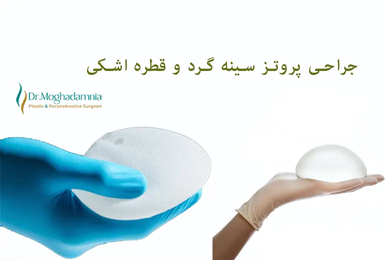 جراحی پروتز قطره اشکی و گرد