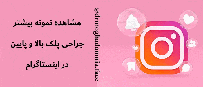 اینستاگرام جراحی پلک