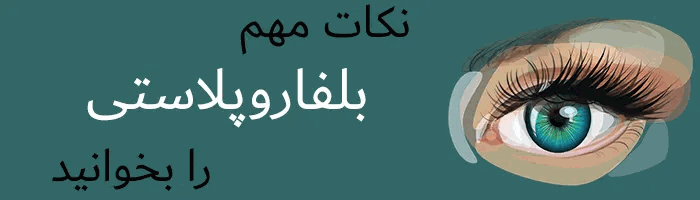 بلفاروپلاستی