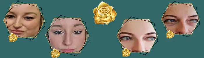 قبل و بعد جراحی پلک