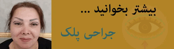 جراحی پلک