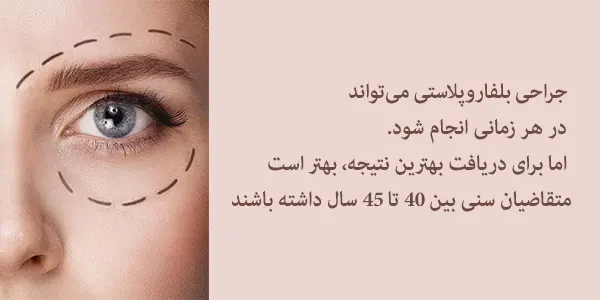سن جراحی پلک