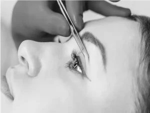 مراقبت های جراحی پلک